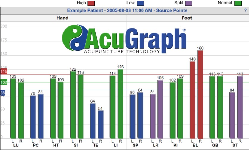 What is the AcuGraph?
